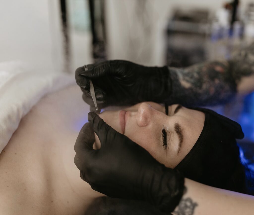 A woman is recieving an acne treatment near Pittsburgh, including facial extractions