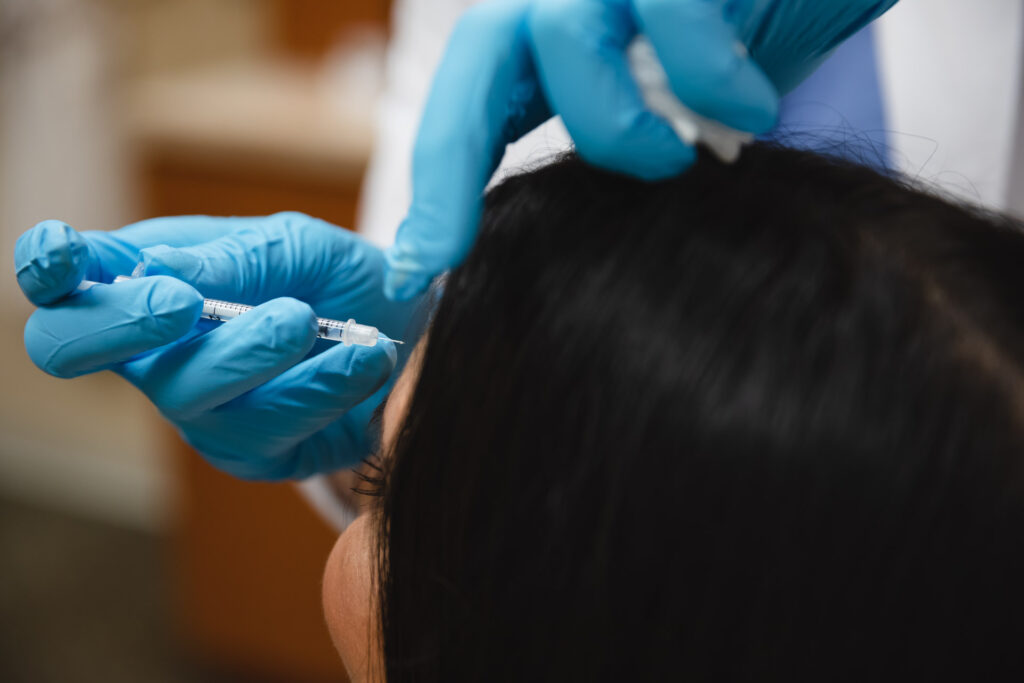 Close up of a woman's Botox injection, which is how to get rid of forehead lines
