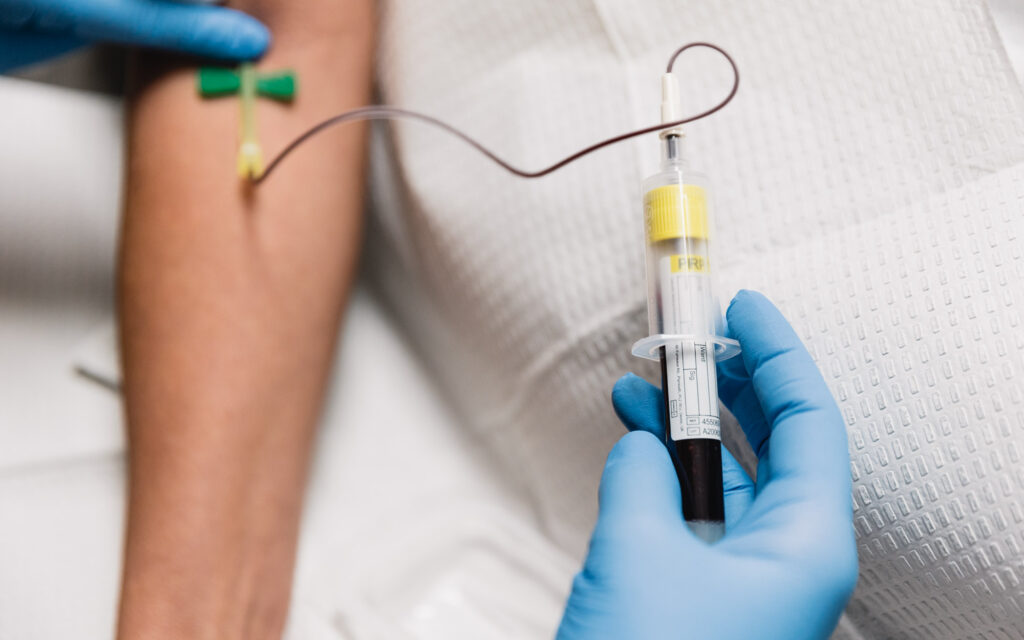 Close up of PRF injection near Moon Township, PA